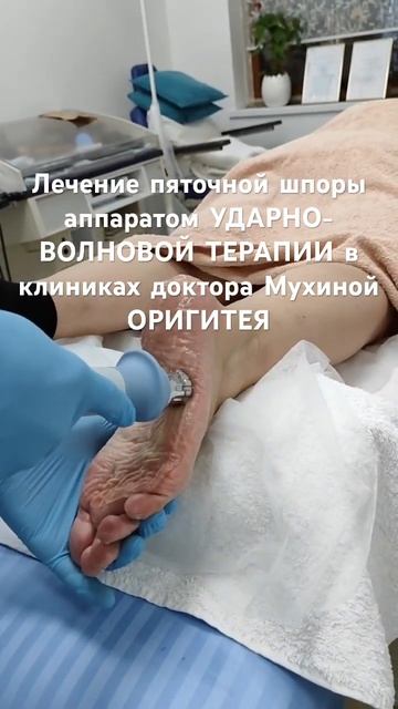 #ударноволноваятерапия #шпора #пяточнаяшпора #ортопед смотреть онлайн