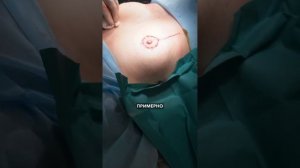 Химиотерапия при раке молочной железы. Отвечаю на воп?