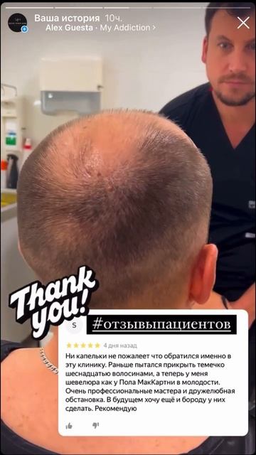 Пересадка волос в Санкт-Петербурге. Т.8(964)342-52-82 #переса? смотреть онлайн