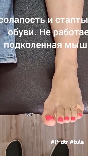 Косалапие, стаптывание обуви, плоскостопие. Причина-т? смотреть онлайн