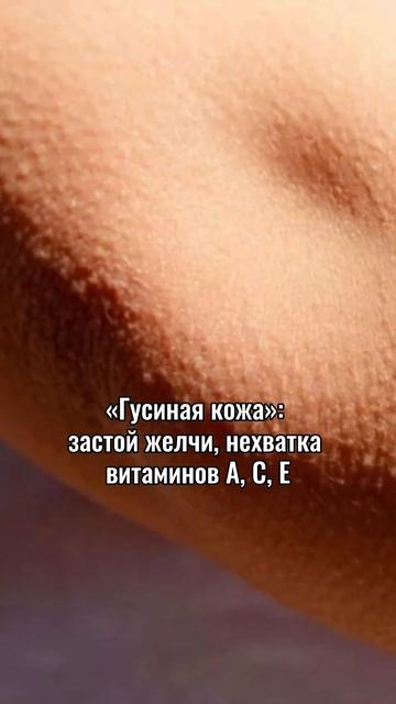 ДАРЮ 👆 пошаговый план как гарантированно СБРОСИТЬ ЛИ смотреть онлайн