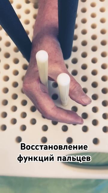 Восстановление функций рук после перелома смотреть онлайн