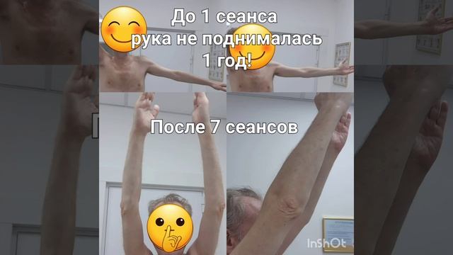 Восстановление плечевого сустава #рекомендации #масс? смотреть онлайн
