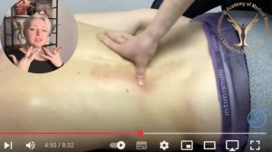 Массаж при грыжах, протрузиях и остеохондрозе | Мнение