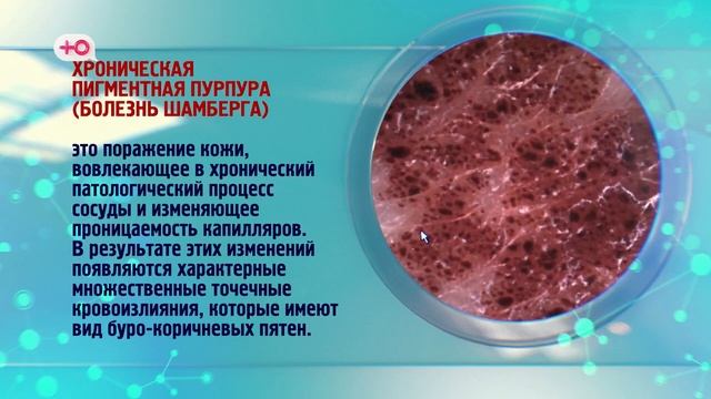 Я стесняюсь своего тела Россия Сезон 2 Выпуск 1 S02E01 смотреть онлайн