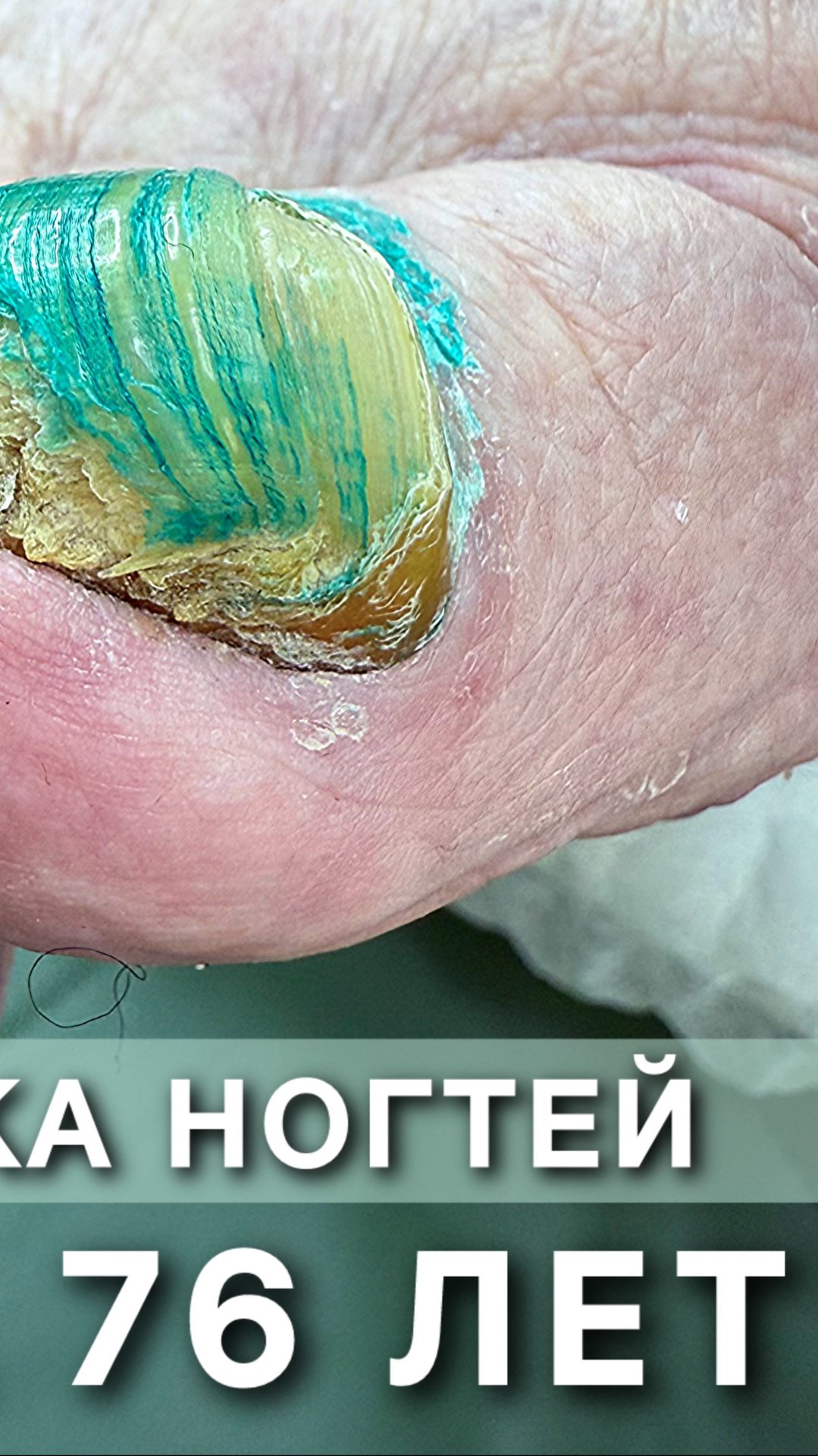 Бабушке 76 лет