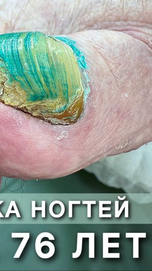 Бабушке 76 лет