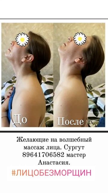 массаж лица. Фото до и после сеанса. смотреть онлайн