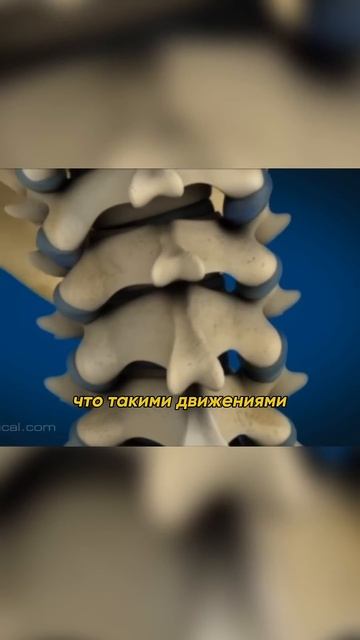 Почему ОПАСНО хрустеть шеей? #болитспина #остеохондро? смотреть онлайн