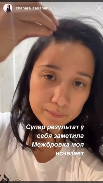 Уменьшилась межбровка, волосы начали расти, увлажните смотреть онлайн