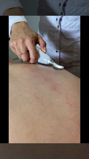 Массаж Гуаша смотреть онлайн