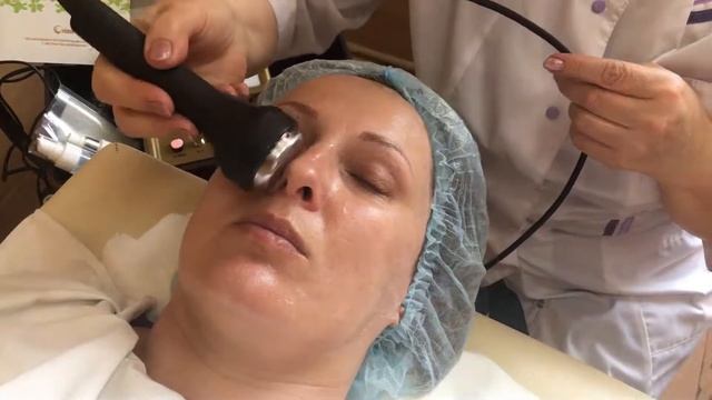 МАССАЖ ЛИЦА УЛЬТРАЗВУКОВОЙ НАСАДКОЙ   БЭМ 3 0  FOHOW  bZS2ytFCBD
