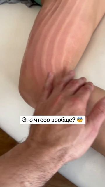 #massage #коррекцияфигуры #гладкаякожа #похудение #бездие? смотреть онлайн