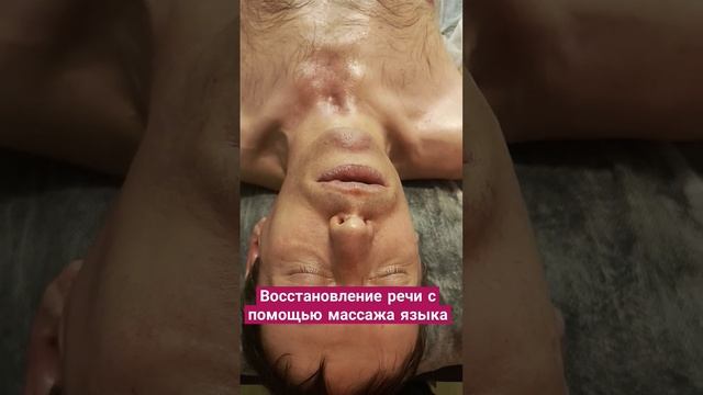 После инсульта человек вообще не говорил. #лаурасатум? смотреть онлайн