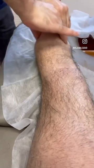 Хиджама ноги Москва +79660102202 смотреть онлайн