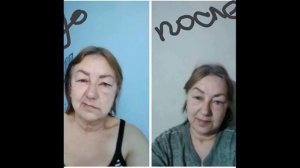 #БИОЭНЕРГОМАССАЖЕР #FOHOW #РЕЗУЛЬТАТЫ В ФОТОГРАФИЯХ