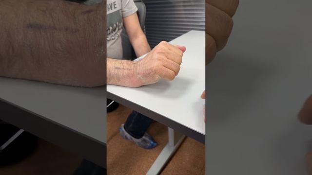 Функция Руки через 4 недели после перелома | Перелом Лу смотреть онлайн