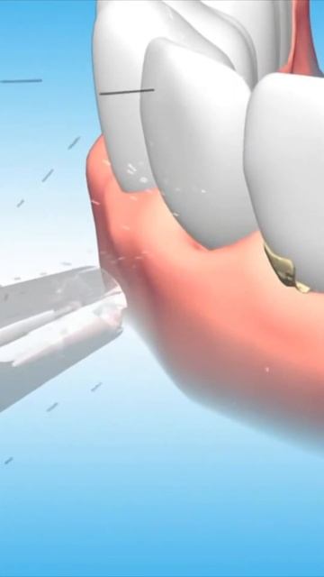 Ирригатор. Принцип работы на примере Revyline RL630 смотреть онлайн