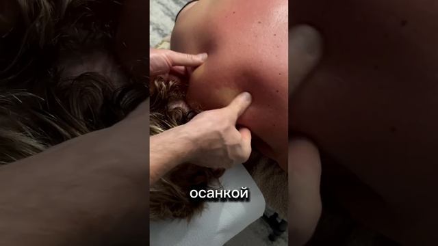 Холка на шее. Вдовий горб . Как избавиться #холка #масса смотреть онлайн
