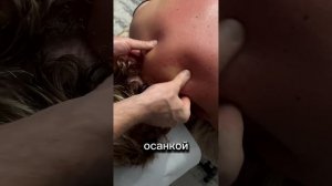 Холка на шее. Вдовий горб . Как избавиться #холка #масса