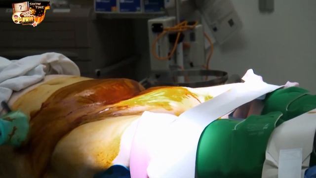 Я вешу 300 килограмм  Что было дальше 7 сезон 1 эп