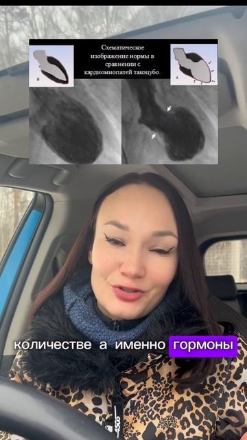 Можно ли умереть от любви? #гормоны #эндокринолог #горм смотреть онлайн