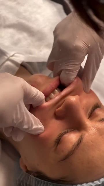 БУККАЛЬНЫЙ МАССАЖ ВКЛИНИК смотреть онлайн