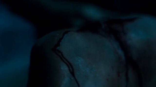 Нужно разогнать кровь, ослабить повязку. ( Отмель ) смотреть онлайн