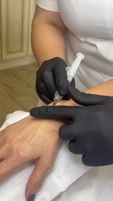 Увлажнение рук. Сухость рук. Морщины на руках. #увлажне смотреть онлайн