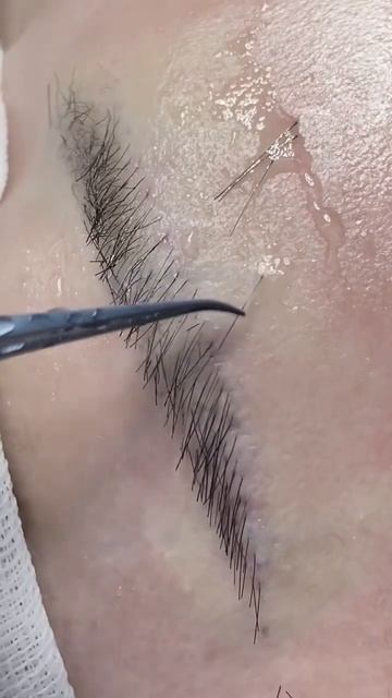 #植眉#植发 #种植睫毛 #пересадка бровей смотреть онлайн