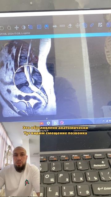 Описание МРТ #массаж #классическиймассаж #мануальнаят смотреть онлайн