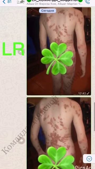 Отзывы клиентов- потрясающие результаты от применени? смотреть онлайн