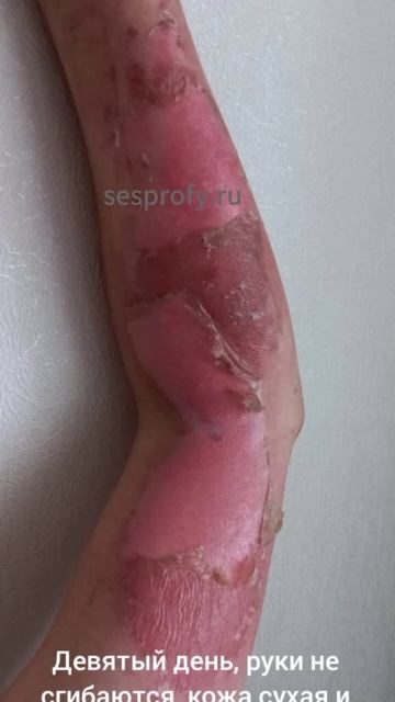 #борщевик #мастер #биология #кожа Читай внимательно! #с? смотреть онлайн