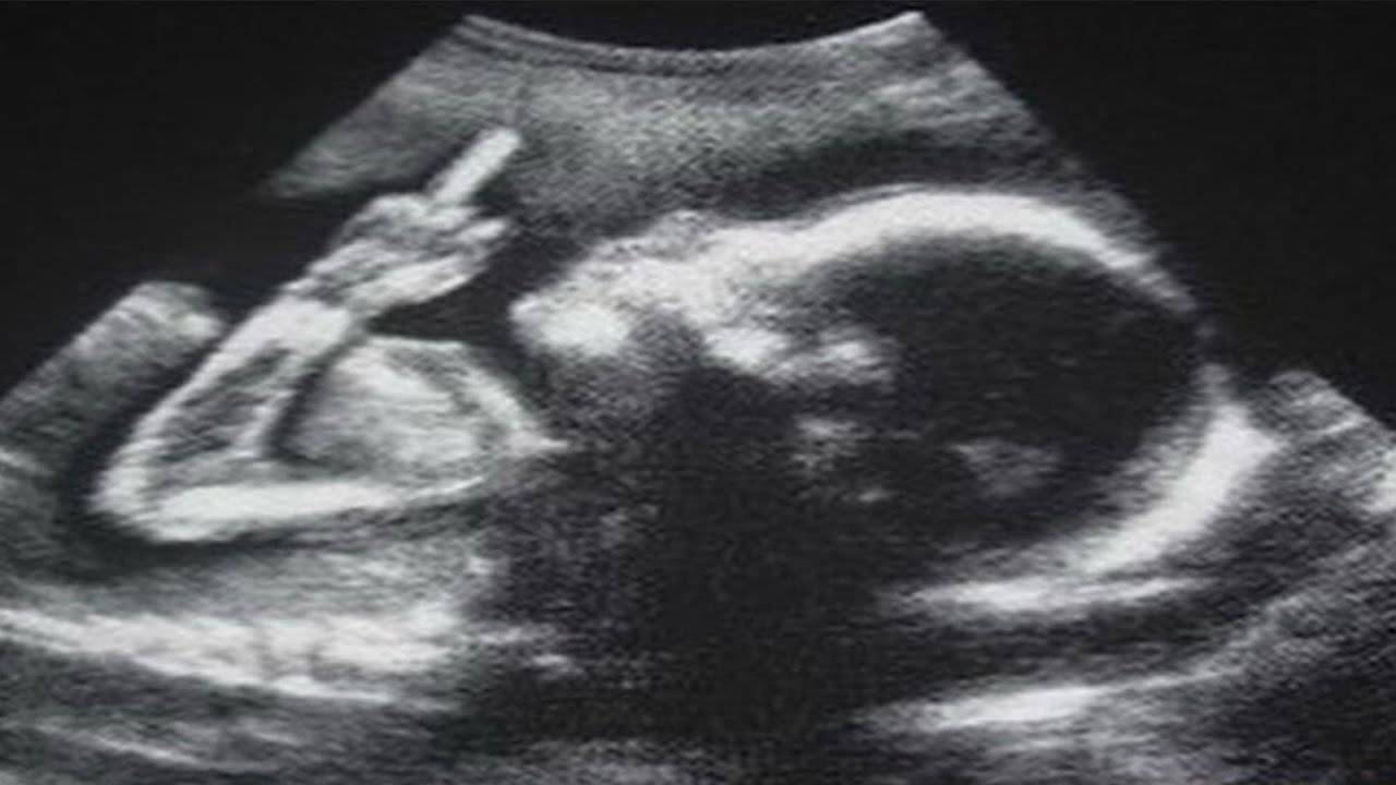 YOU LAUGH YOU GET CANCER (StreetCan) смотреть онлайн