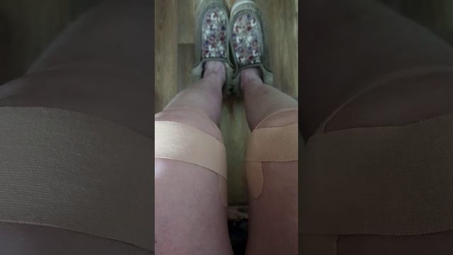 ТЕЙП НА КОЛЕННЫЕ СУСТАВЫ | ВЕС НОРМА смотреть онлайн