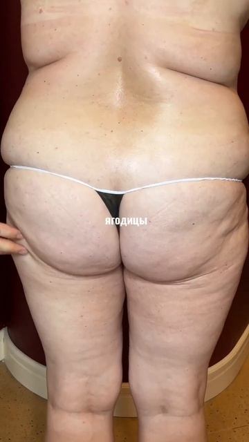 Консультация по коррекции фигуры #shorts смотреть онлайн