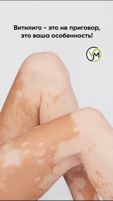 #витилиго #vitiligo #кожноезаболевание #кожныезаболев#вит? смотреть онлайн