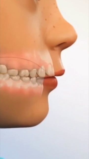 Прикус ребенка