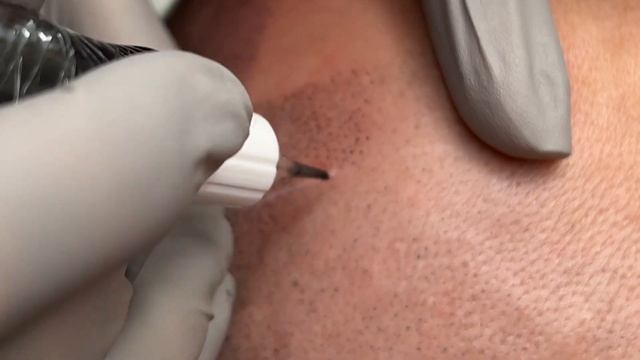 трихопигментация