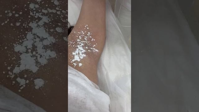 Проведение процедуры депиляции #лазернаяэпиляция #депиляция #электроэпиляция #косметология смотреть онлайн