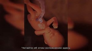 17 неделя беременности