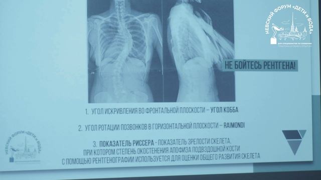 Сколиоз/Почему бассейн не поможет смотреть онлайн