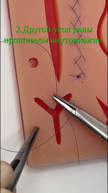 Ушивание Y-образного разреза скоро на канале|SurgeON #меди смотреть онлайн