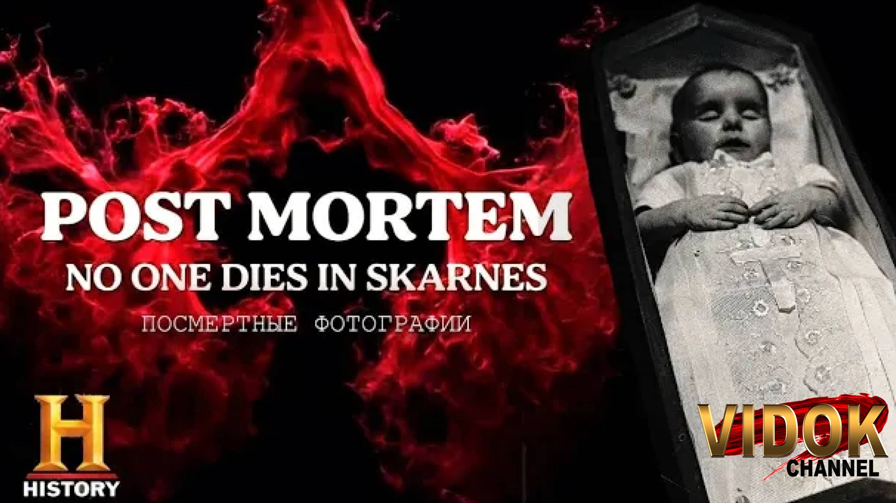 ПОСТ МОРТЕМ (POST MORTEM). ИСТОРИЯ ВИКТОРИАНСКОГО ВРЕМЕНИ С ЖУТЧАЙШИМИ ОБЫЧАЯМИ. #топыкатегорий смотреть онлайн