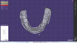 Как создать модель зуба в EXOCAD. Model Creator обучение