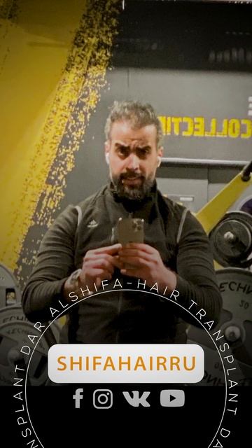 Опыт одного из наших клиентов по пересадке волос. Запи