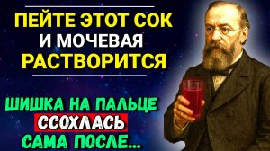 Пол стакана ЭТОГО Сока растворяет Мочевую. Гениальный Врач терапевт Сергей Боткин