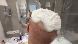 Восстановление после пересадки волос / Клиника GG Med