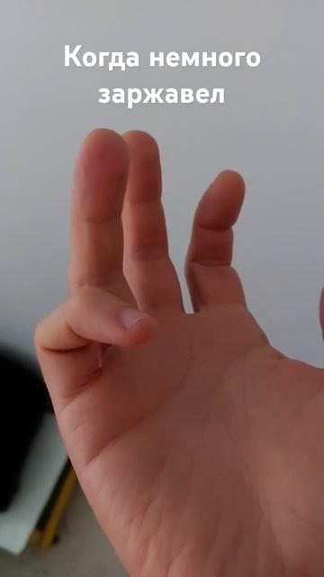 Спазм мышц руки. Сломанный робот. смотреть онлайн