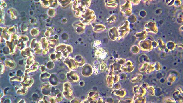 Кровь под микроскопом MAGUS Bio 260 смотреть онлайн